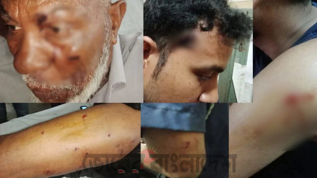 কুষ্টিয়ার পদ্মা নদীতে গুলাগুলিতে ৫ পুলিশ গুলিবিদ্ধ