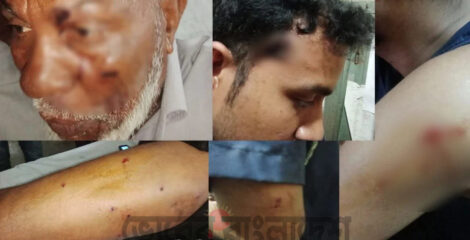 কুষ্টিয়ার পদ্মা নদীতে গুলাগুলিতে ৫ পুলিশ গুলিবিদ্ধ