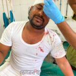 ধান কাটার শ্রমিকের টাকা লুট, সাংবাদিককে কুপিয়ে জখম