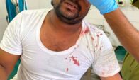 ধান কাটার শ্রমিকের টাকা লুট, সাংবাদিককে কুপিয়ে জখম