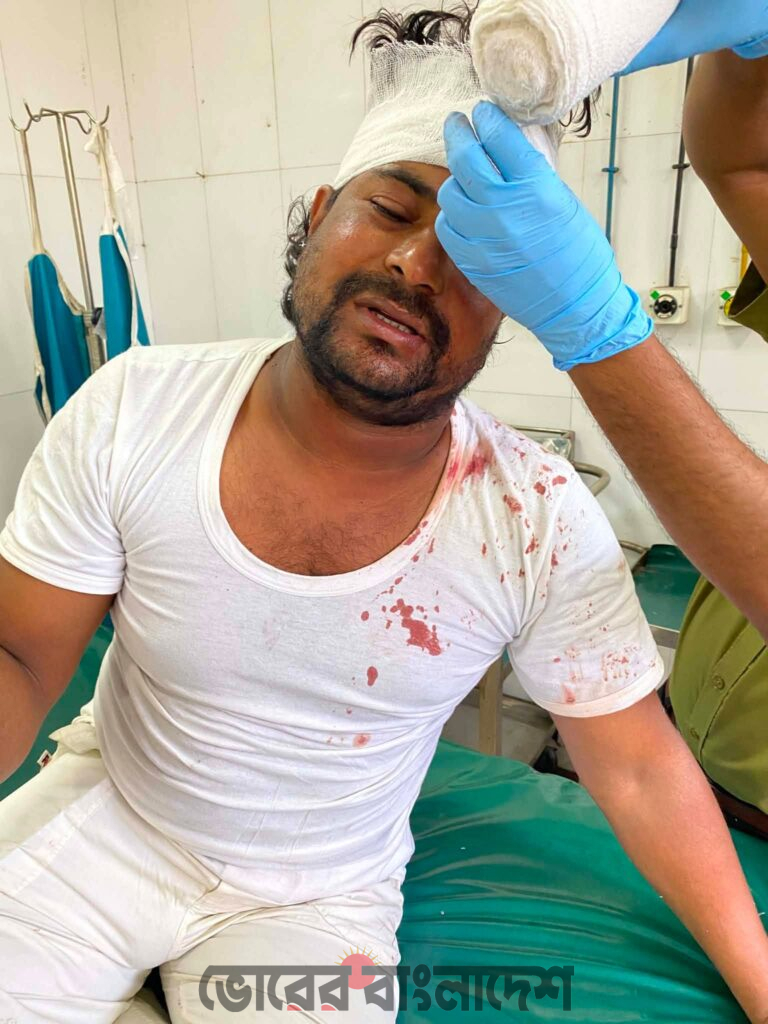 ধান কাটার শ্রমিকের টাকা লুট, সাংবাদিককে কুপিয়ে জখম