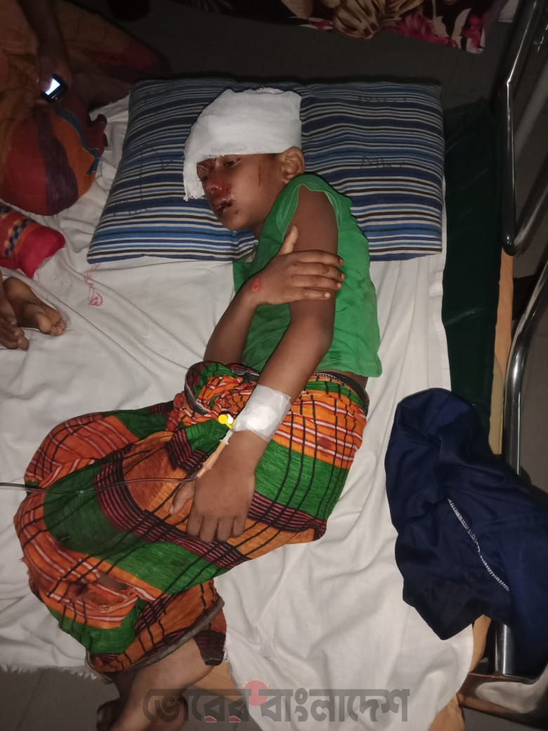 লংগদুতে মাহিন্দ্রা-অটোরিকশার মুখো*মুখি সং*ঘ*র্ষ, প্রা*ণ গেল ২ বছরের শিশুর