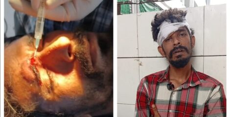 স্বেচ্ছাসেবক দল কর্মী নাহিদের বাড়িতে হামলা: ছুরিকাঘাত, মামলা প্রস্তুতি