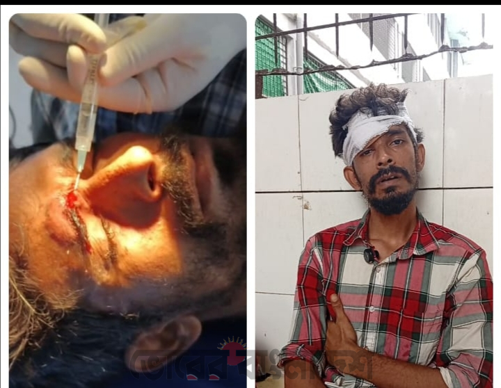 স্বেচ্ছাসেবক দল কর্মী নাহিদের বাড়িতে হামলা: ছুরিকাঘাত, মামলা প্রস্তুতি
